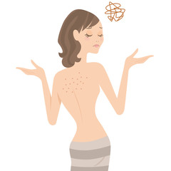 背中のニキビ　女性