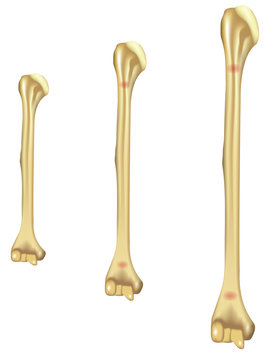 Growing Pains Humerus