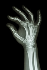 human's hand and OK symbol