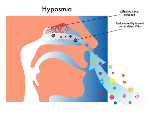 Iposmia