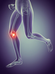 woman having pain in the knee