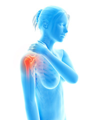 a woman having acute pain in the shoulder joint