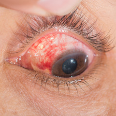 eye examination