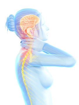 woman having a painful neck - visible nerves
