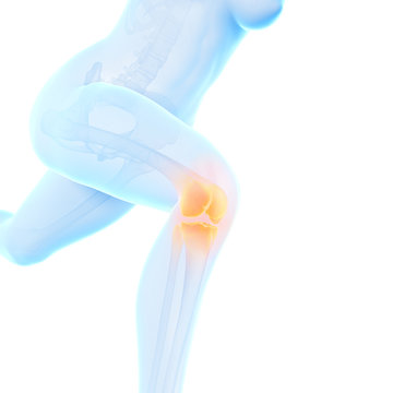 illustration of a running woman - painful knee