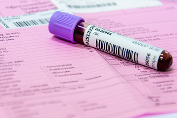 Medical test tubes with blood in laboratory