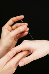 Acupuncture on hand, close up, on dark background