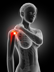 woman having pain in the shoulder