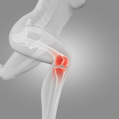 illustration of a running woman - painful knee