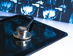 stethoscope on digital tablet in laboratory on x-ray image - obrazy, fototapety, plakaty