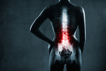 Spine in x-ray. The lumbar spine is highlighted by red colour. - obrazy, fototapety, plakaty