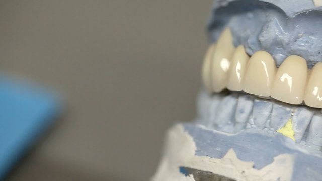 dental dentist objects implants