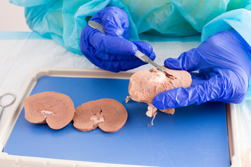 Medical student in anatomy dissecting a kidney
