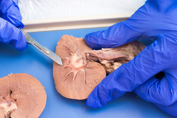 Internal structure of a sheep kidney