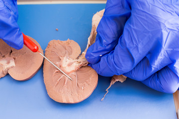 Student studying a dissected sheep kidney