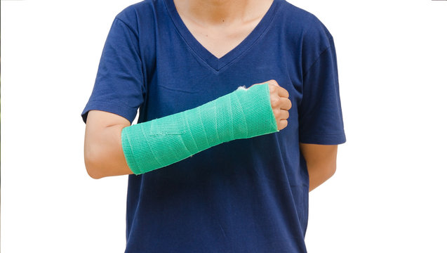 green cast on hand and arm on white background