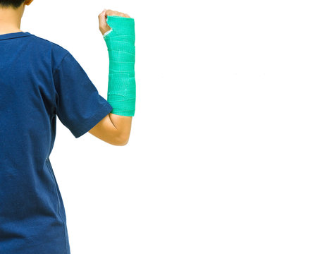green cast on hand and arm on white background