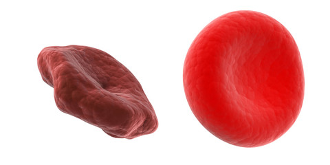 scientific illustration - healthy and unhealthy blood cell