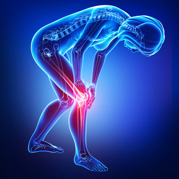 Anatomy of female knee pain in blue
