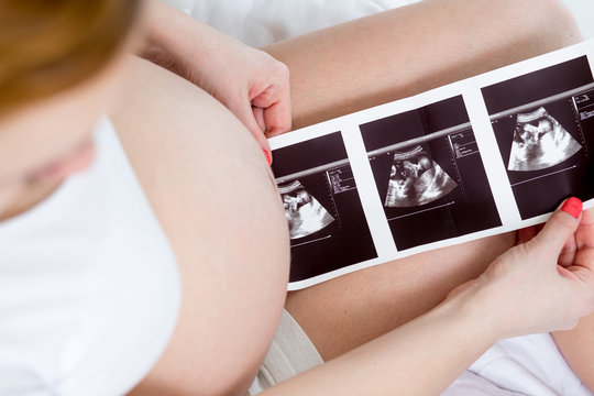 Pregnant woman reviewing baby ultrasound scan