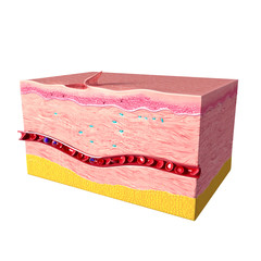 Anatomy of  tissue repair in human skin