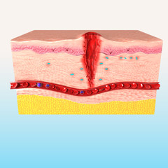 3d Anatomy of  tissue repair in human skin