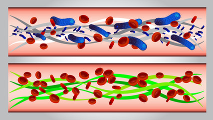 illustration of  Red blood cells and bacteria in artery vector