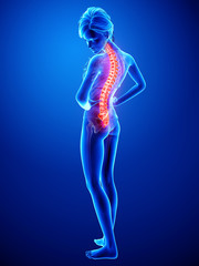 3d Anatomy of female back pain in blue