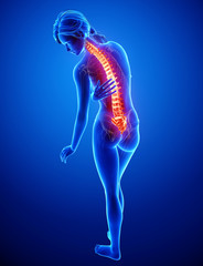 3d Anatomy of back pain in blue