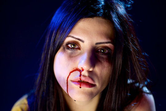 woman with bleeding nose after domestic violence