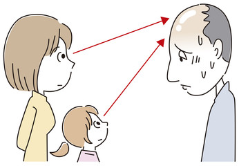 髪の生え際に悩む男性