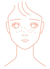 そばかすに悩やむ女の子