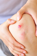 sports injured knee