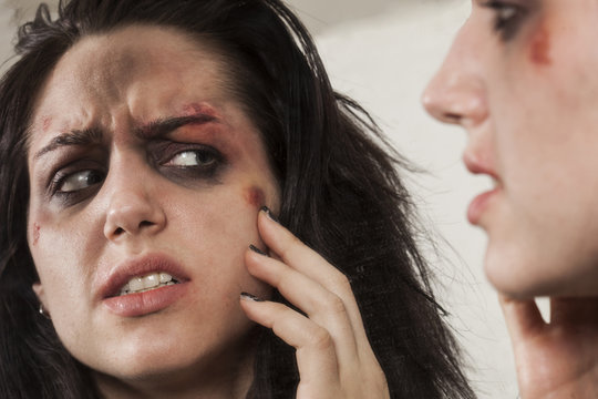 Beaten up girl looking in the mirror