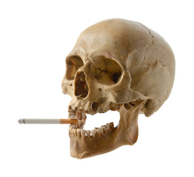 Skull of the person with a cigarette.