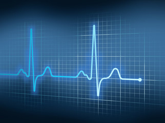 EKG