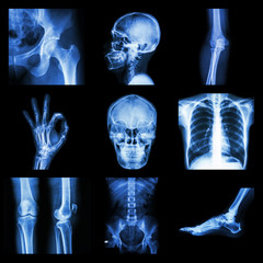 Colection part of human