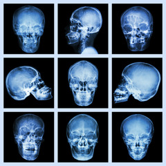 Collection of asian skull