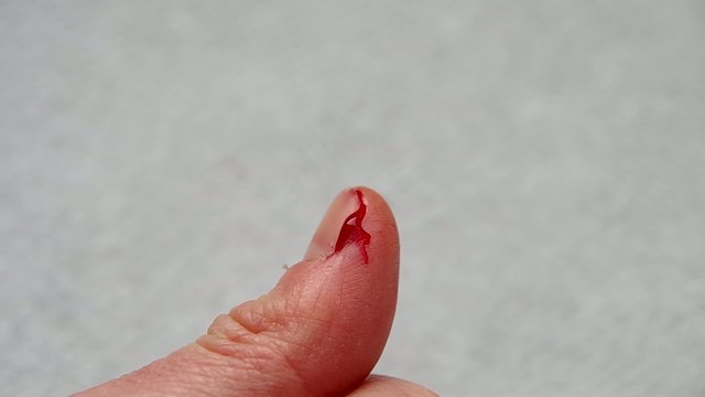 The cut thumb on the hand, and blood