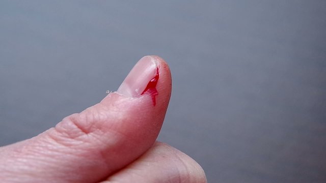 The cut thumb on the hand, and blood