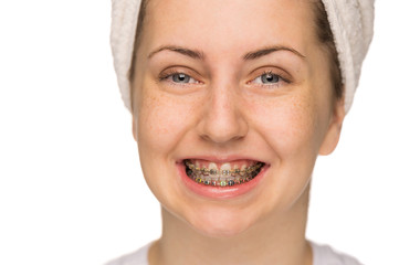Cheerful girl with braces isolated