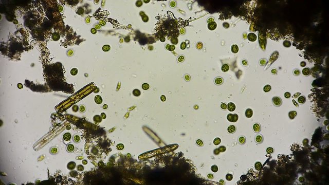 Mikroorganismen unter dem Mikroskop in Full HD
