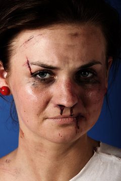 Woman after an injury