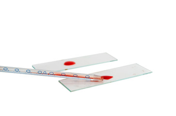 drop of blood with a pipette isolated