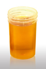 Yellow Urine  Medical analysis