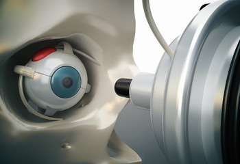 laser eye surgery or lasik medical operation concept - 64432840