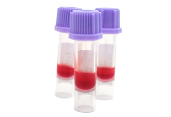 vials of blood