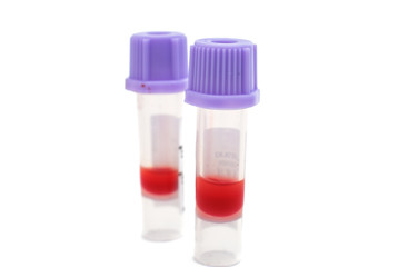 vials of blood