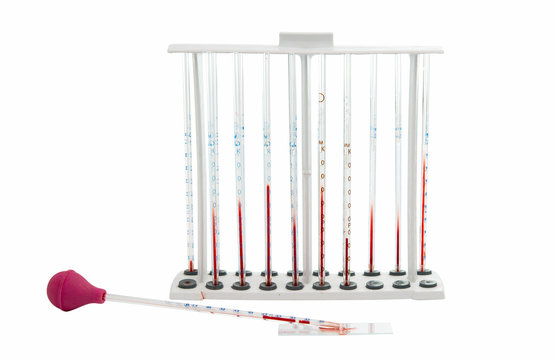 pipette with blood isolated