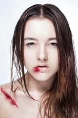 beautiful girl with a scar on face and shoulder